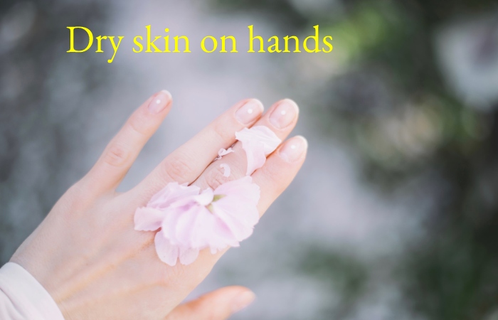 Dry skin on hands (1)