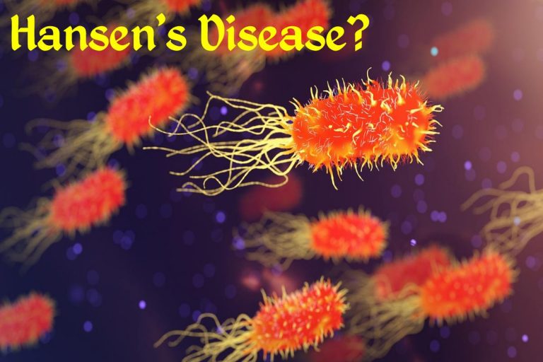 Hansen's Disease
