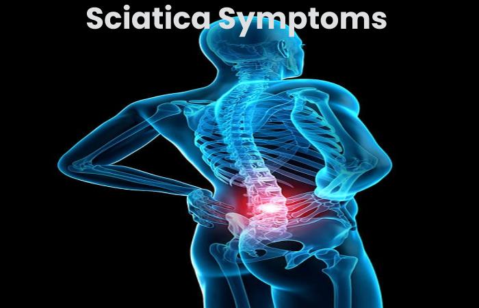 Sciatica Symptoms