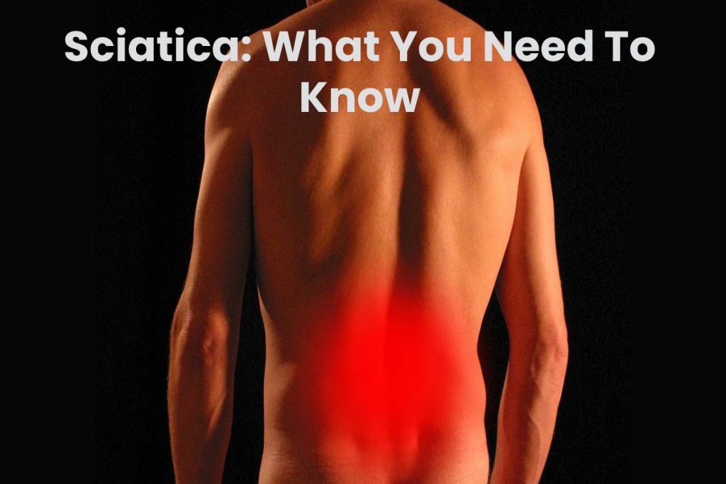 Sciatica: What You Need To Know